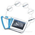 New Product Full Digital Palm Ultrasound Scanner with Built-in Li-Battery